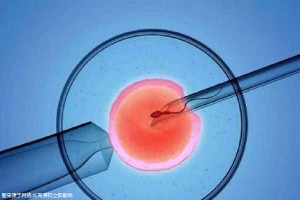 爱心拉拉代怀咨询怎么选